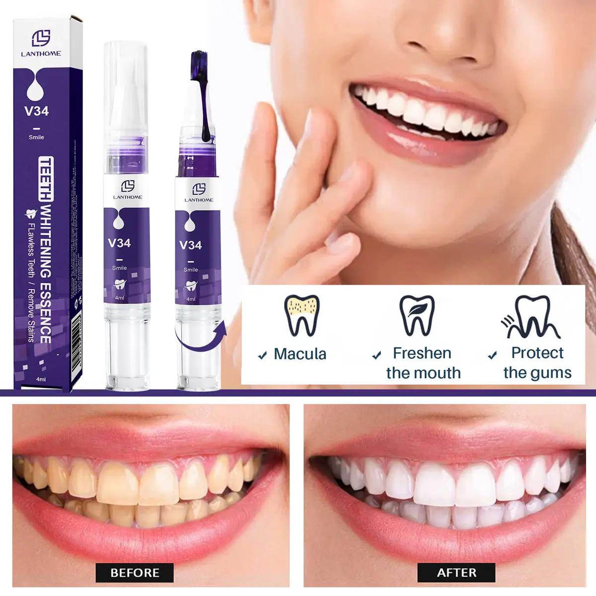 V34 Teeth Whitening Pen